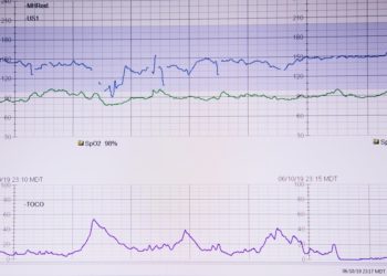 Il medico svizzero Nussbaumer afferma in TV che il sindaco di Lugano, Borradori, era appena stato vaccinato prima di morire di simil-infarto!