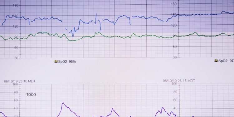 Il medico svizzero Nussbaumer afferma in TV che il sindaco di Lugano, Borradori, era appena stato vaccinato prima di morire di simil-infarto!