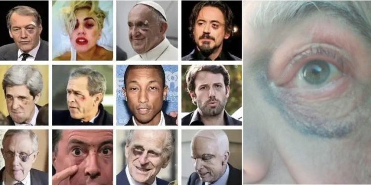 Per evitare la guerra in Europa ci vuole un Papa veramente Cristiano facente funzione (che Davos NON vuole)