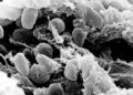 Finalmente una spiegazione sul perchè i preparati mRNA COVID non sono stati testati sulla cancerogenicità (terribile prospettiva)