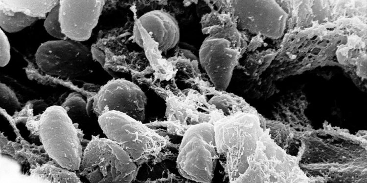 Finalmente una spiegazione sul perchè i preparati mRNA COVID non sono stati testati sulla cancerogenicità (terribile prospettiva)